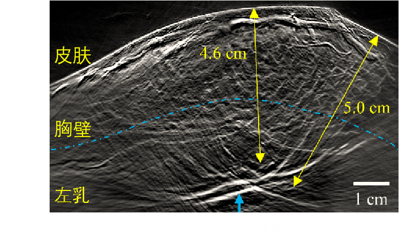 人体乳腺横截面