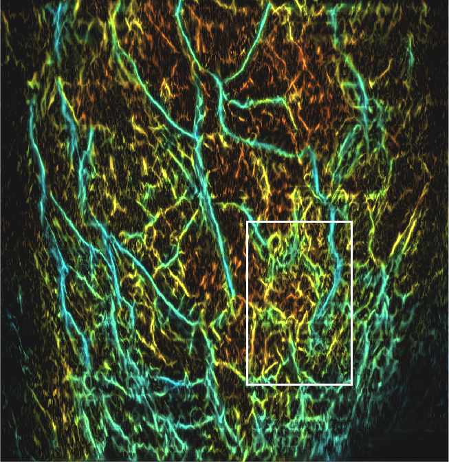 人体全乳腺光声图像