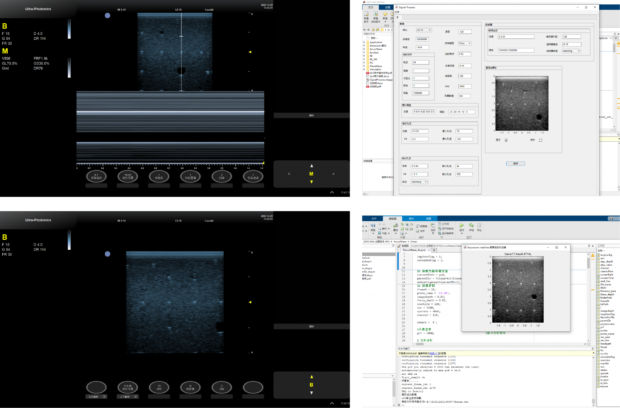 超声研究平台软件界面