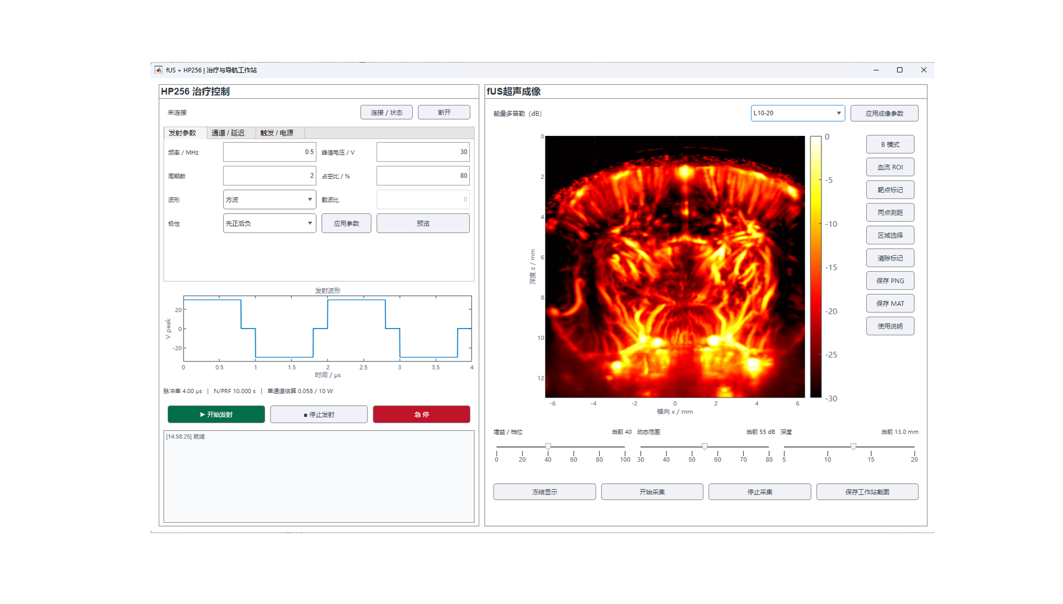 Ultra Thera software
