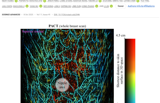 Science Advances│尖端光声成像仪器触动传统行业印象:光声+超声显著提升乳腺肿瘤早期诊断准确性
